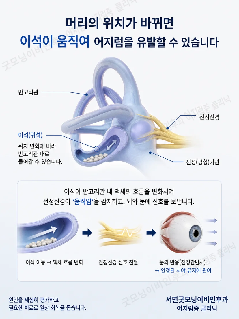 머리 위치 변화와 귀의 평형 감각이 어지럼에 미치는 원리