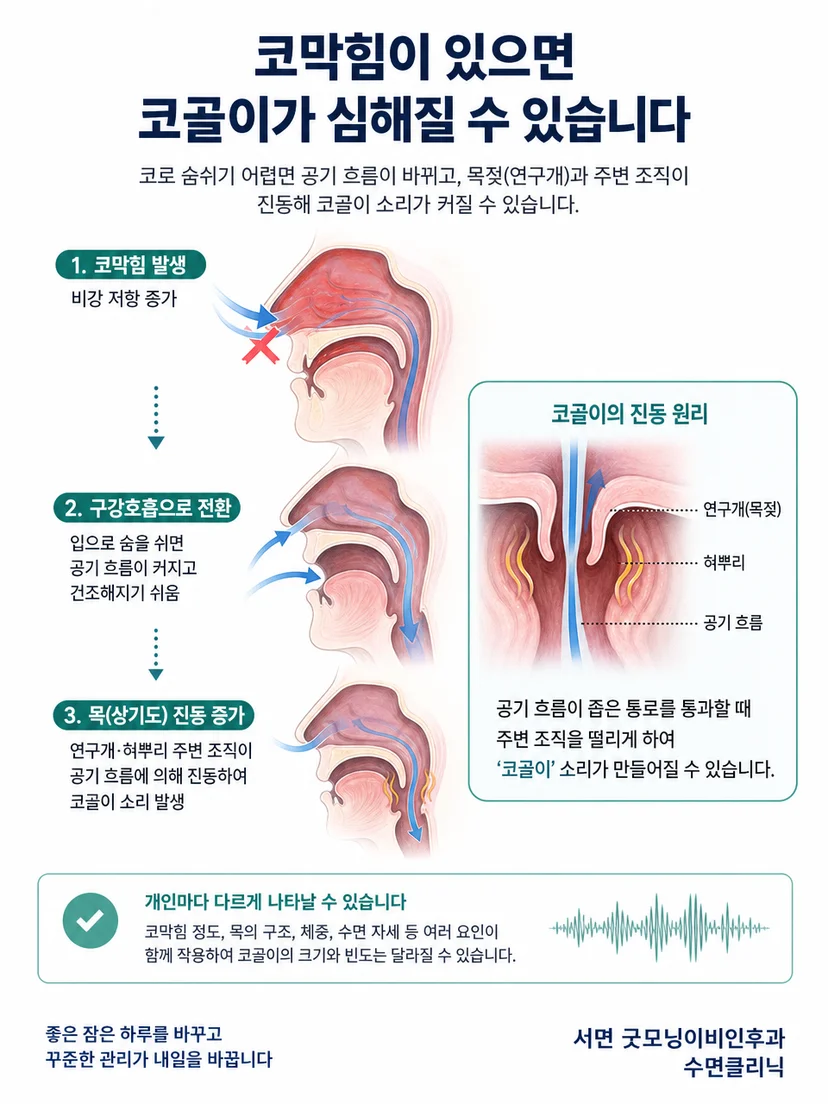 비강 저항과 목 안쪽 조직의 진동으로 생기는 코골이 원리