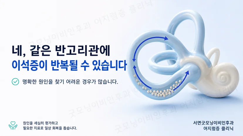같은 반고리관에서 반복될 수 있는 이석증의 핵심 설명