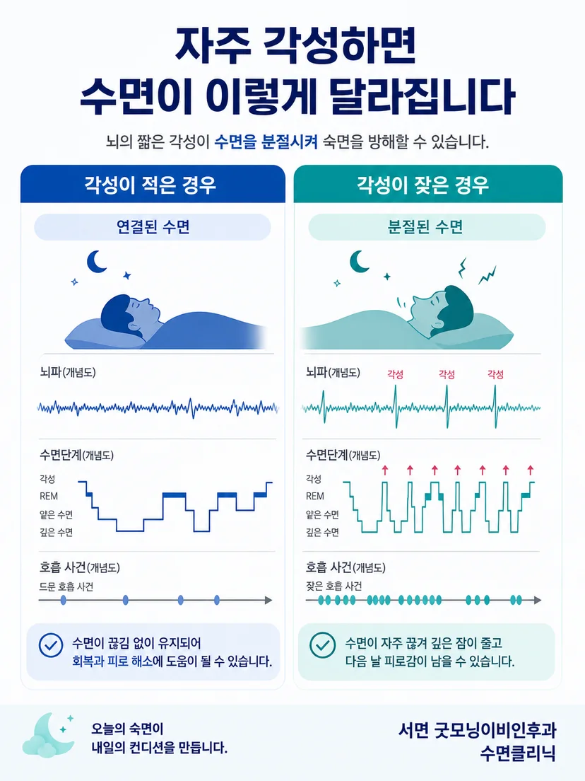 각성지수와 증상 및 다른 검사 항목을 함께 봐야 한다는 설명 이미지