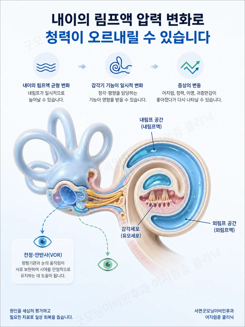내이의 달팽이관과 평형기관 기능 변화를 설명하는 이미지
