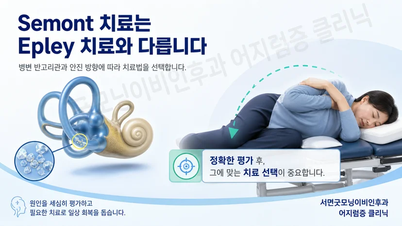 Semont와 Epley 이석치환술의 움직임 차이를 설명하는 그림