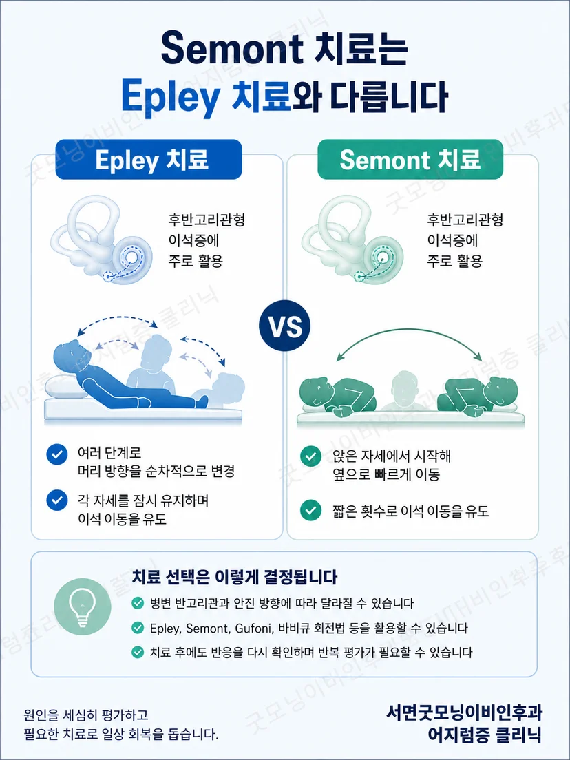 반고리관 위치에 따라 이석치환 자세가 달라지는 점을 보여주는 그림