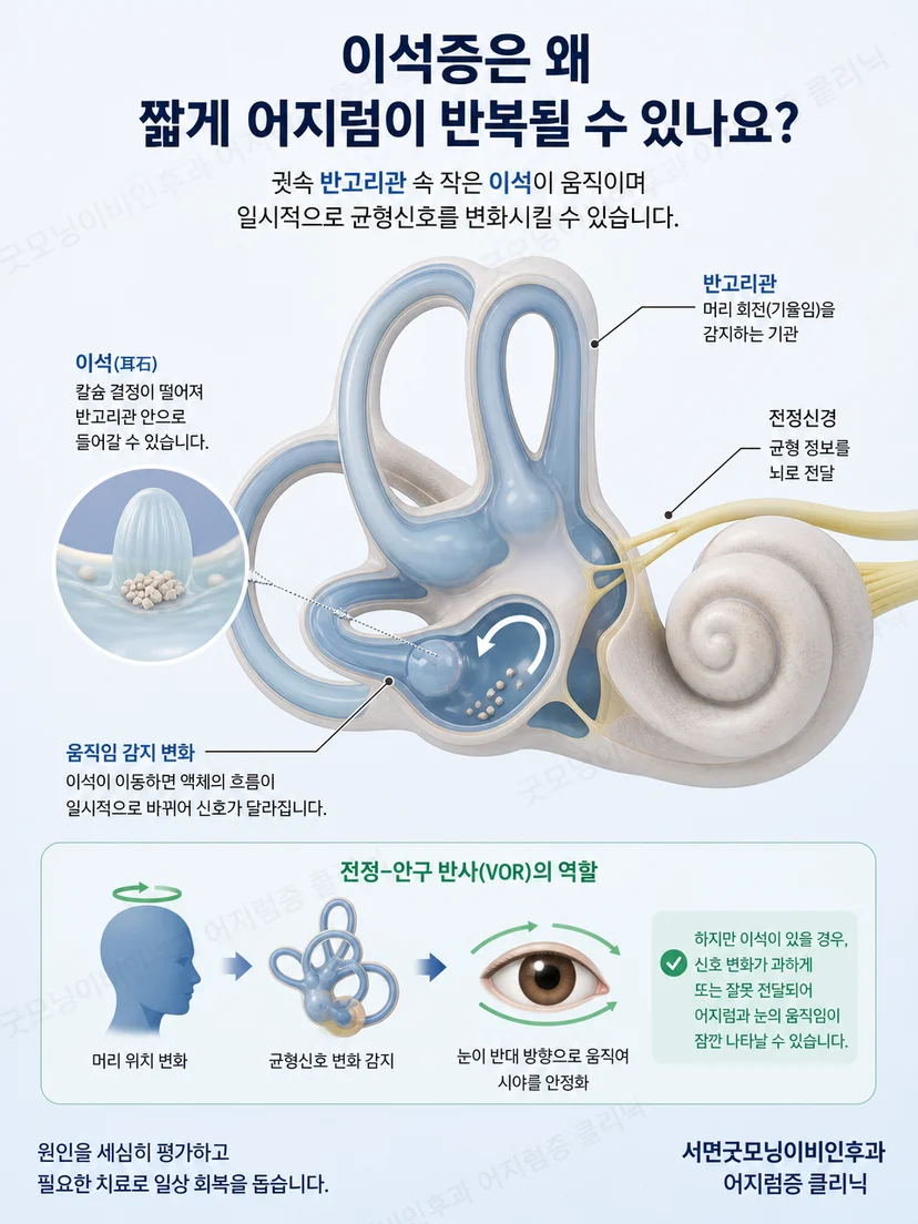내이 반고리관과 머리 위치 변화에 따른 어지럼 발생 원리