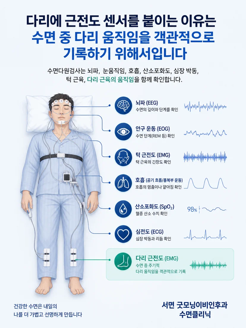 다리 근육의 활동을 센서가 기록하는 원리를 보여주는 설명 이미지