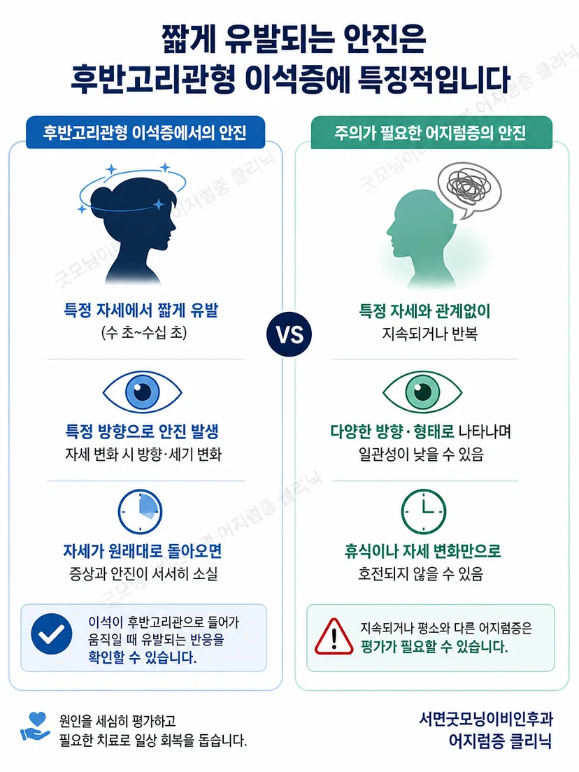 후반고리관형 이석증의 특징적 안진과 해석 시 주의점을 보여주는 그림