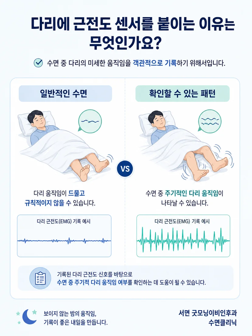 일시적인 뒤척임과 반복적인 다리 움직임의 차이를 설명하는 이미지