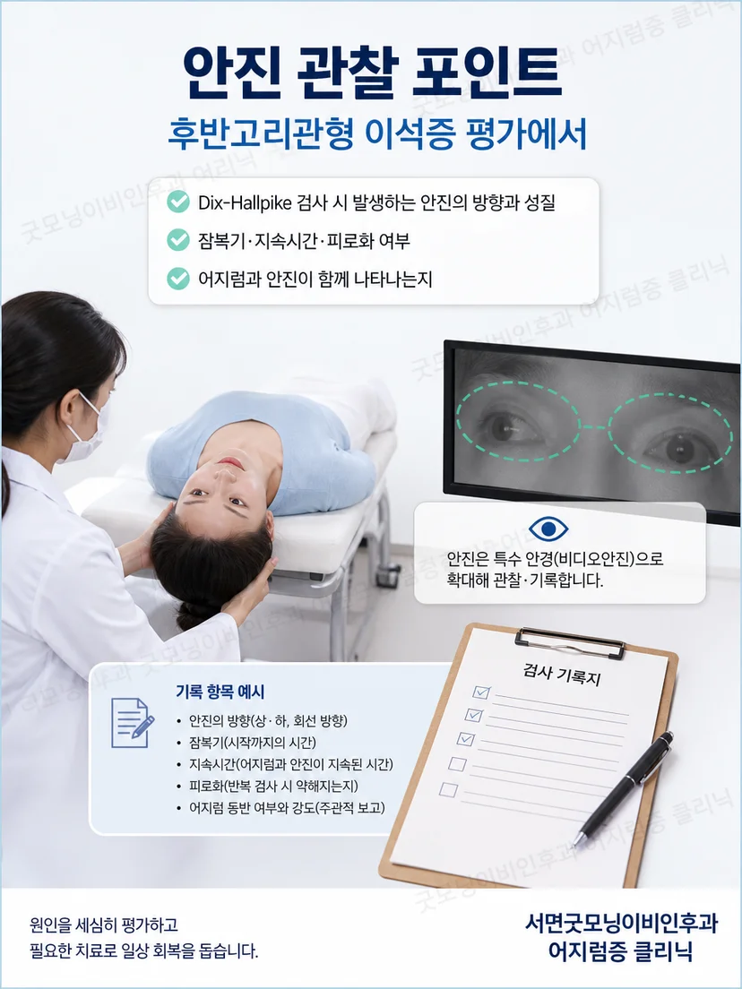 의료진이 Dix-Hallpike 자세검사에서 안진을 관찰하는 과정