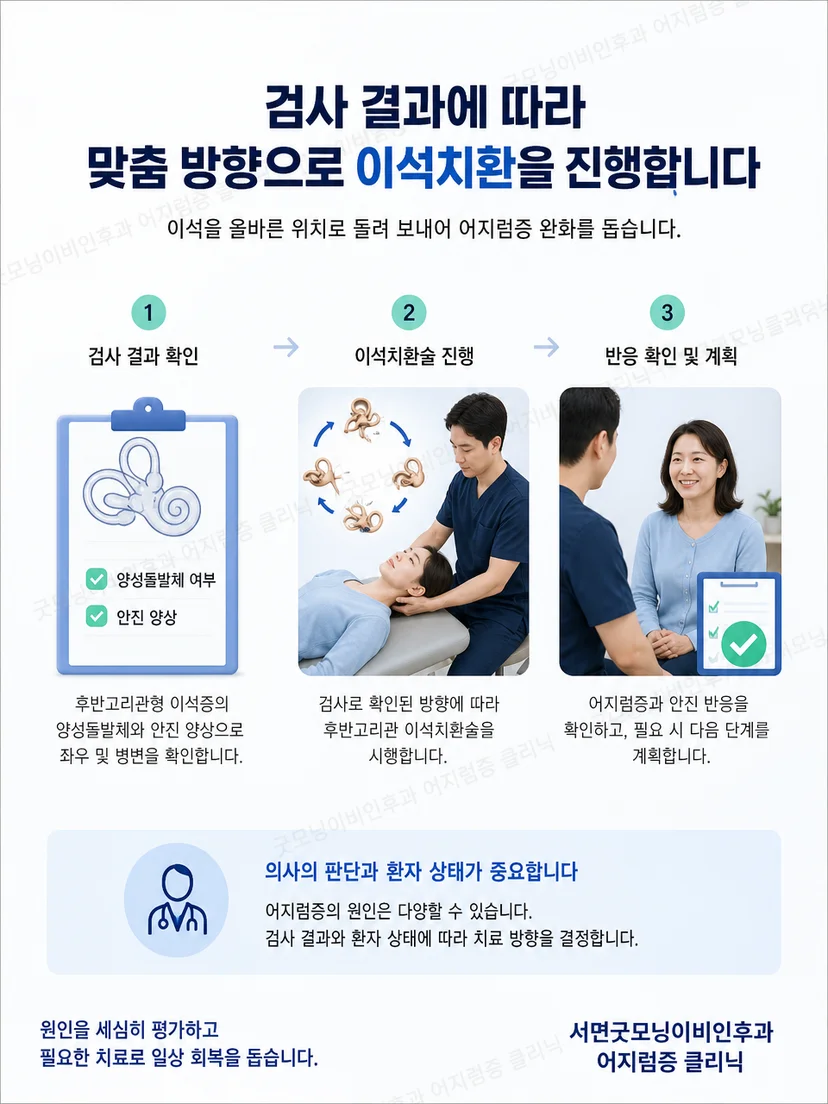 후반고리관형 이석증에서 안진 결과에 맞춰 이석치환술을 시행하는 원리