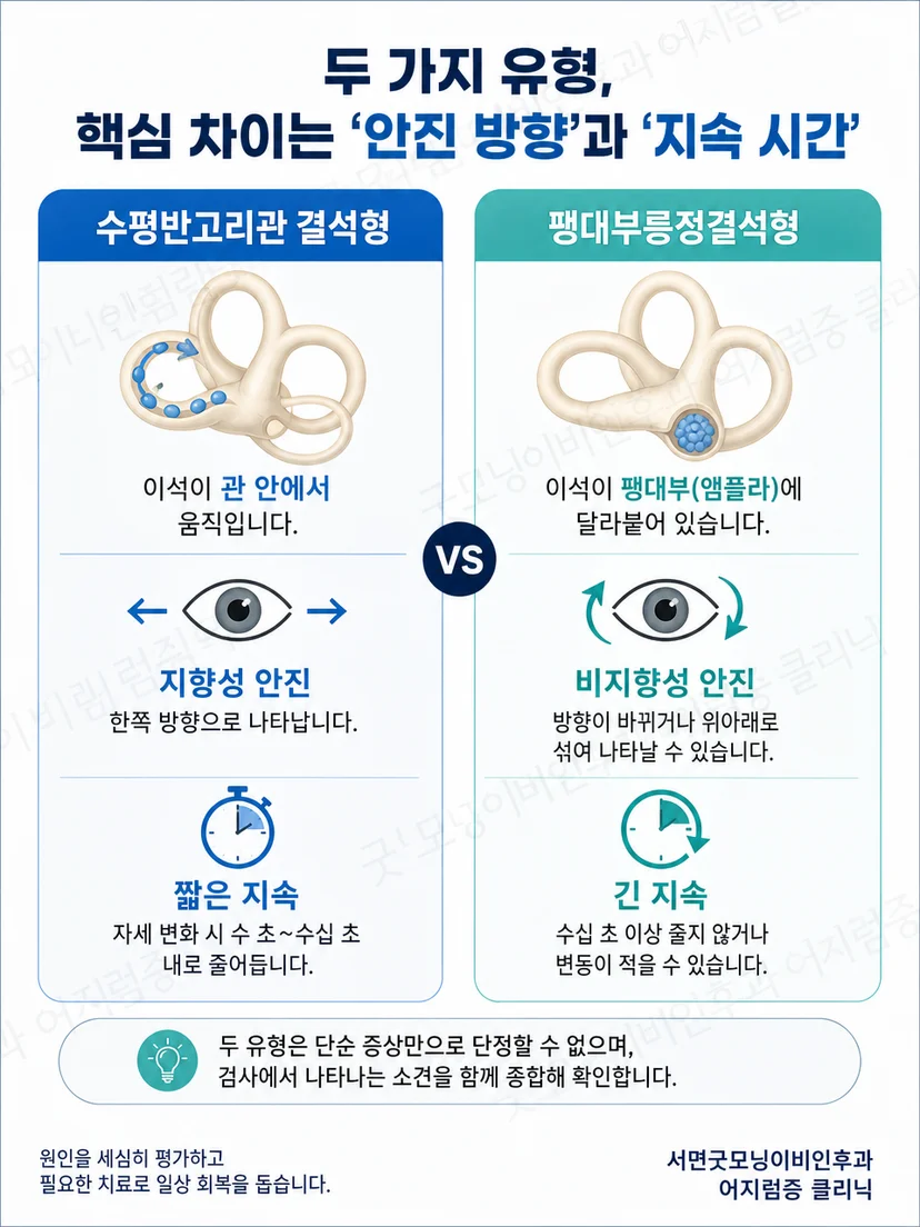 수평반고리관 자세검사에서 지향성과 비지향성 안진을 구별하는 방법