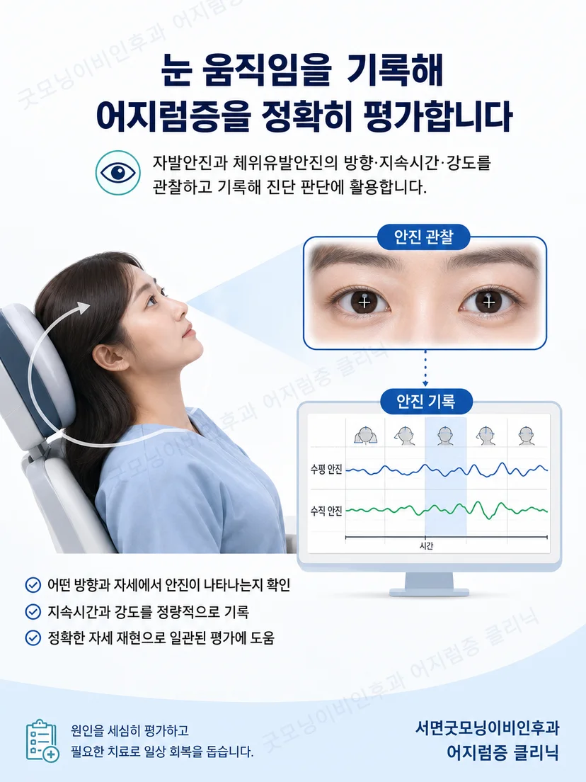 자세 변화 중 안진 기록과 증상을 함께 평가하는 과정의 그림