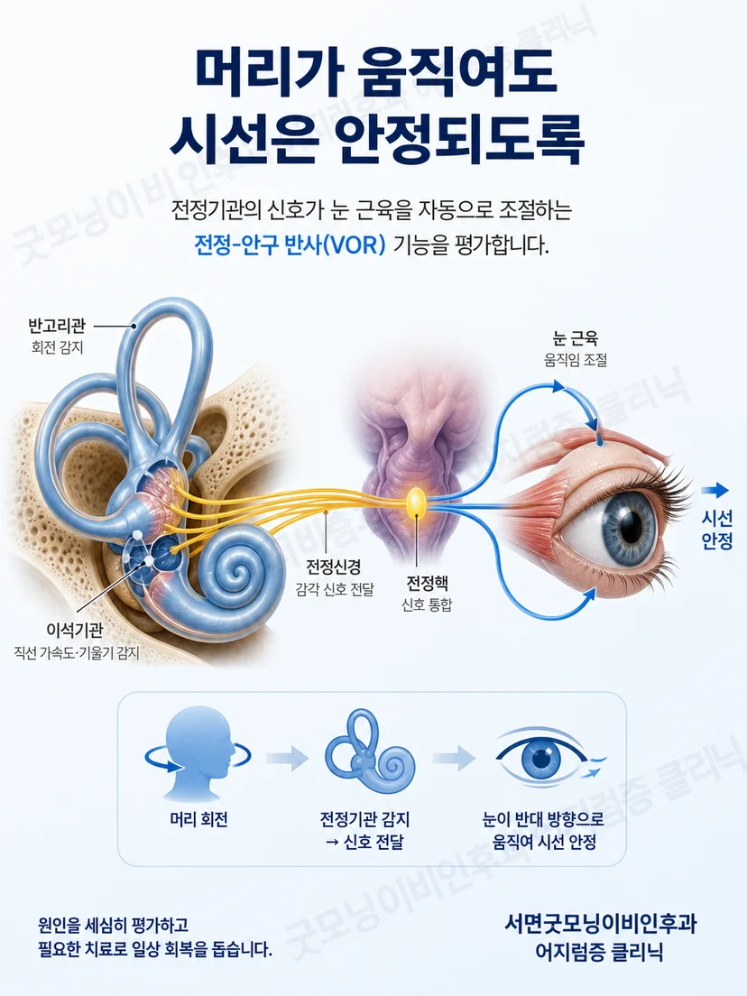 머리 움직임과 눈의 보상 움직임으로 시야가 안정되는 전정안반사 원리