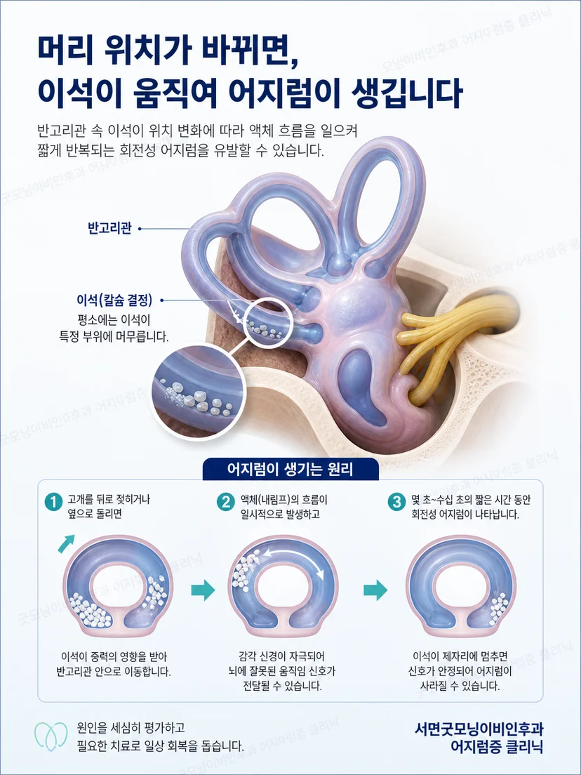 내이 반고리관과 머리 위치 변화에 따른 어지럼 발생 원리