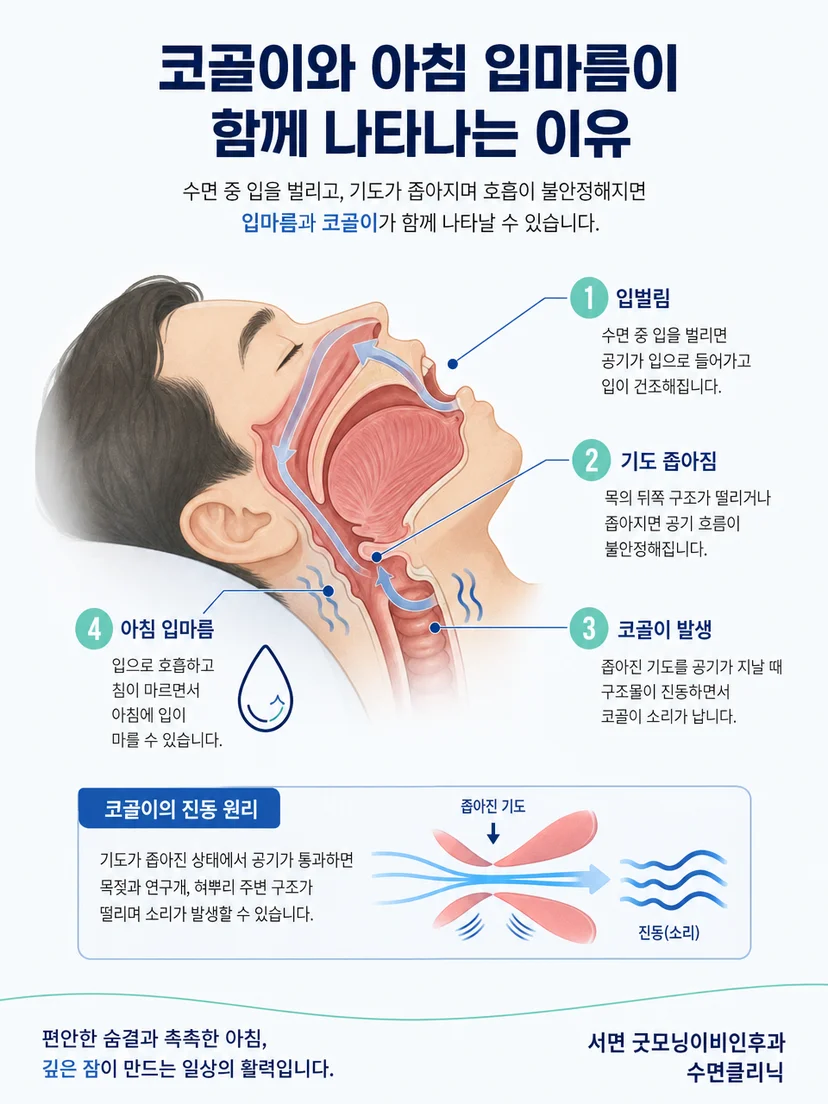 좁아진 상기도에서 주변 조직이 진동해 코골이가 발생하는 원리