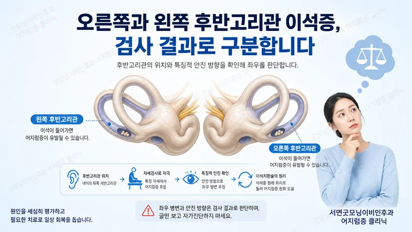 후반고리관 이석증의 좌우 구분 원리를 보여주는 핵심 안내