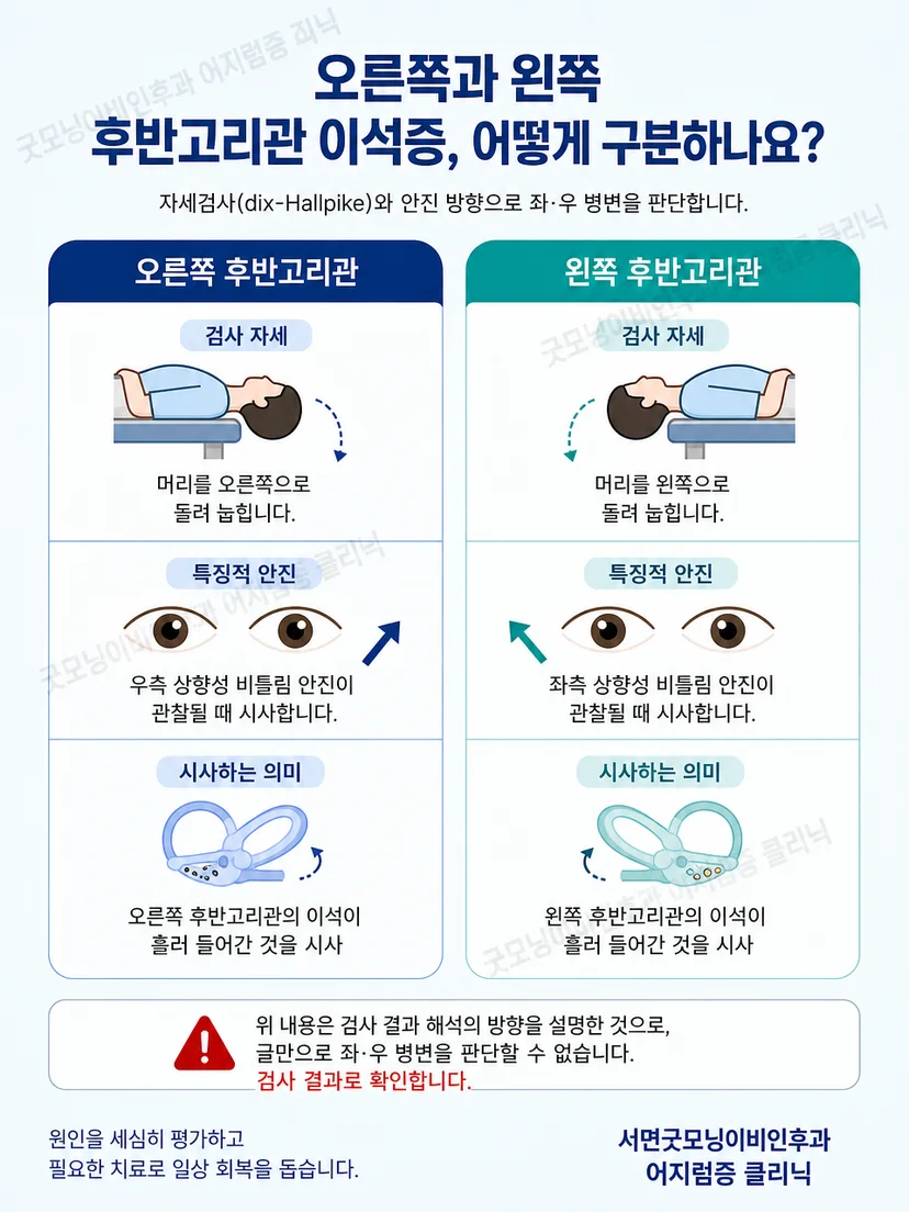 후반고리관 이석증에서 자세와 안진 방향을 함께 구분하는 안내