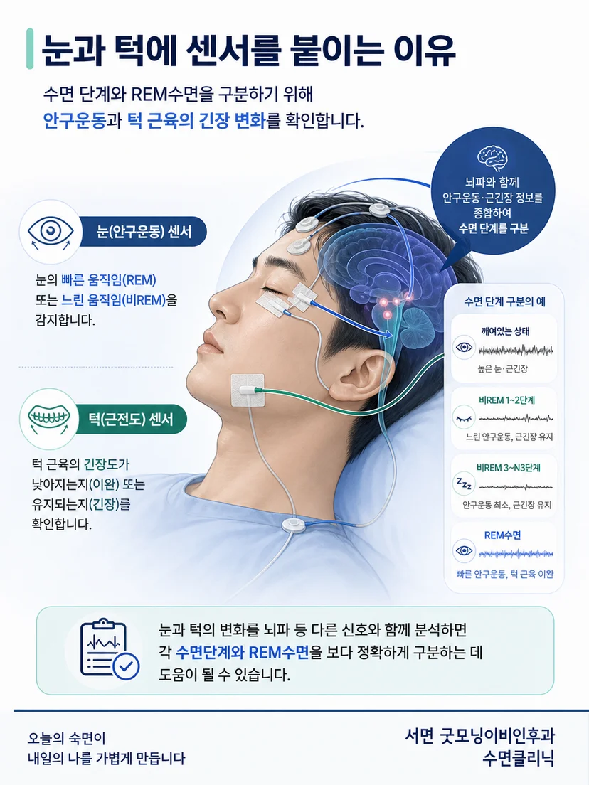 REM수면에서 안구운동과 턱 근긴장이 달라지는 원리