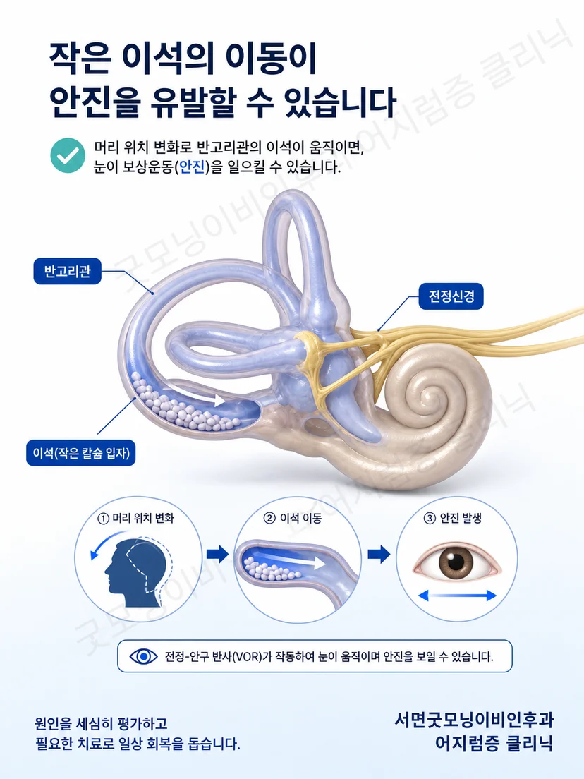 뒤쪽 반고리관과 가쪽 반고리관의 위치 및 자세검사 원리