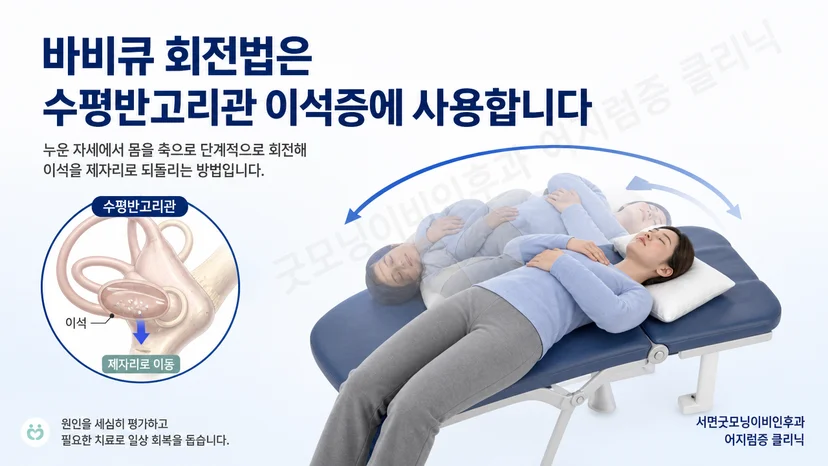 수평반고리관 이석증에서 바비큐 회전법을 선택하는 핵심 원칙