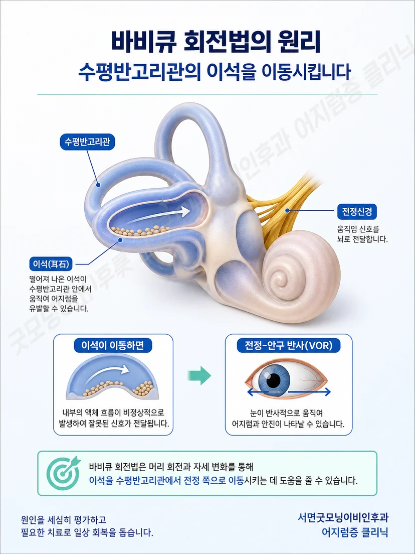 수평반고리관 속 이석이 단계적 회전에 따라 이동하는 원리