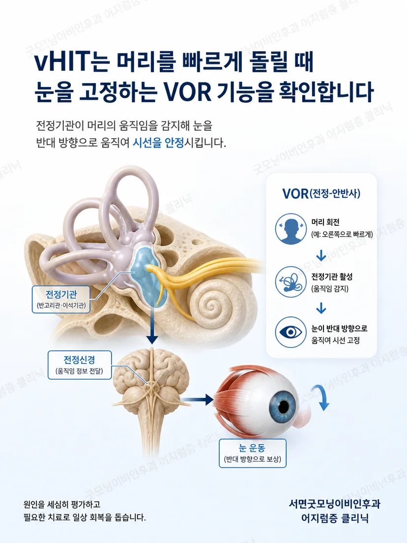 머리 움직임에 반대 방향으로 눈이 움직이는 전정안반사 원리