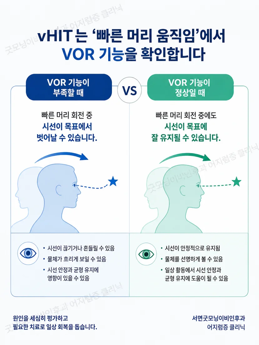 vHIT와 체위성 어지럼을 구분해 평가하는 핵심 안내