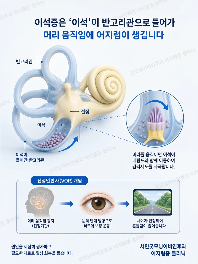 머리 위치 변화와 평형기관 자극의 관계를 설명하는 그림