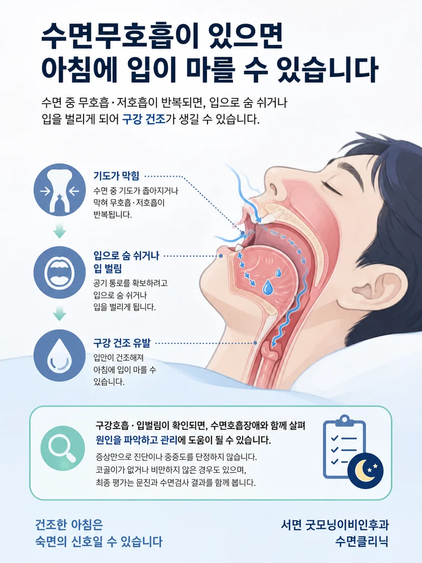 수면 중 입벌림과 구강호흡으로 입안이 건조해지는 과정을 설명하는 이미지