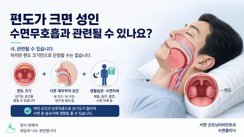 큰 편도와 성인 수면무호흡의 관련성을 설명하는 대표 이미지