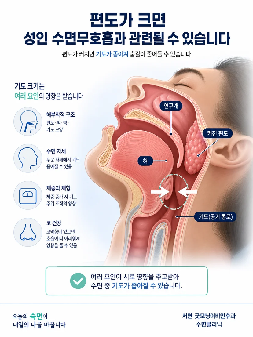 편도와 혀 및 연구개가 상기도 단면에 미치는 영향 설명