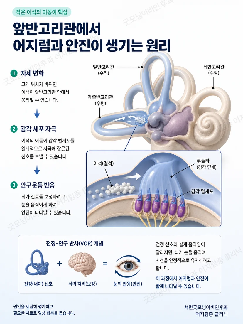 앞 뒤 수평반고리관의 공간 방향을 보여주는 삼차원 내이 도식