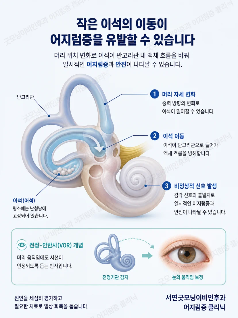 머리 위치 변화와 평형기관 자극의 관계를 설명하는 그림