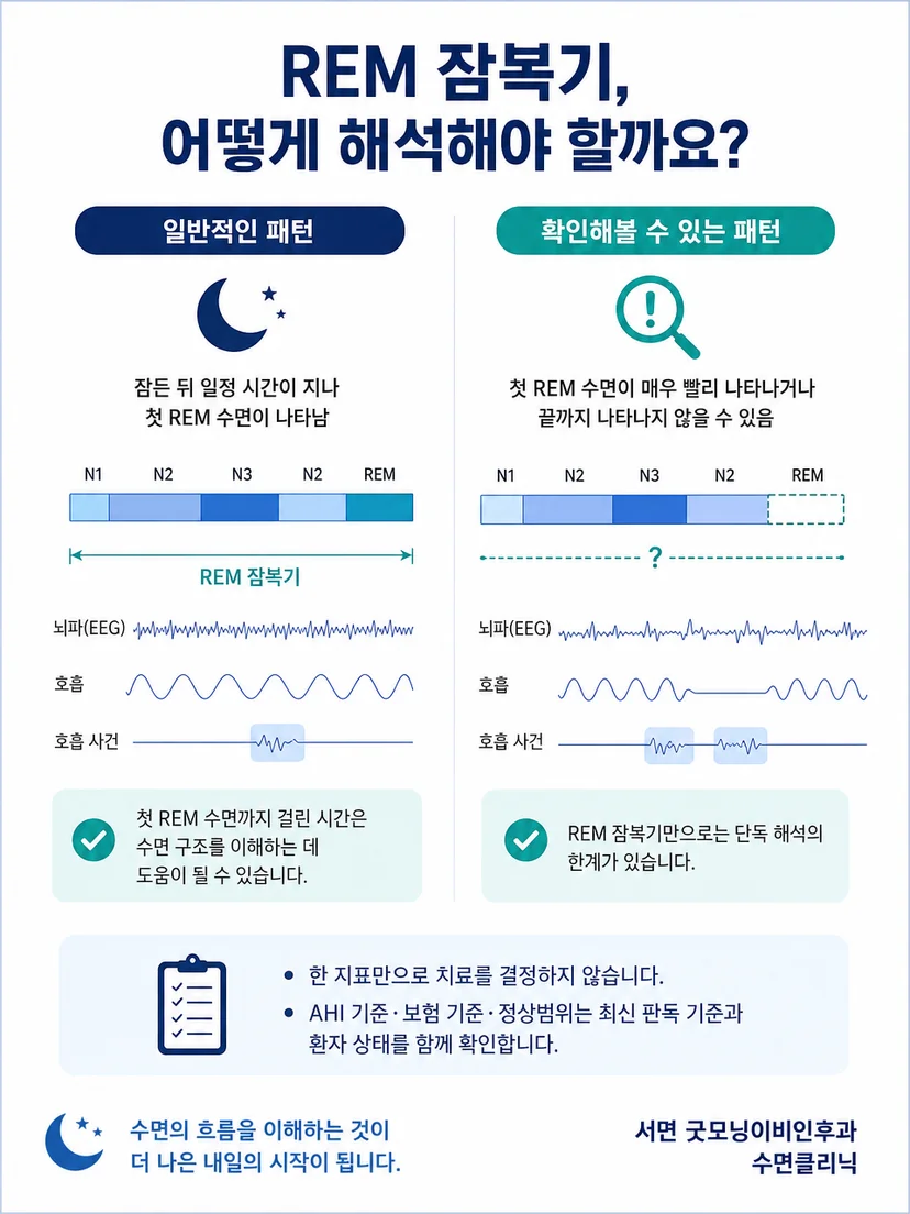 REM 잠복기 단일 수치 해석을 주의해야 한다는 설명