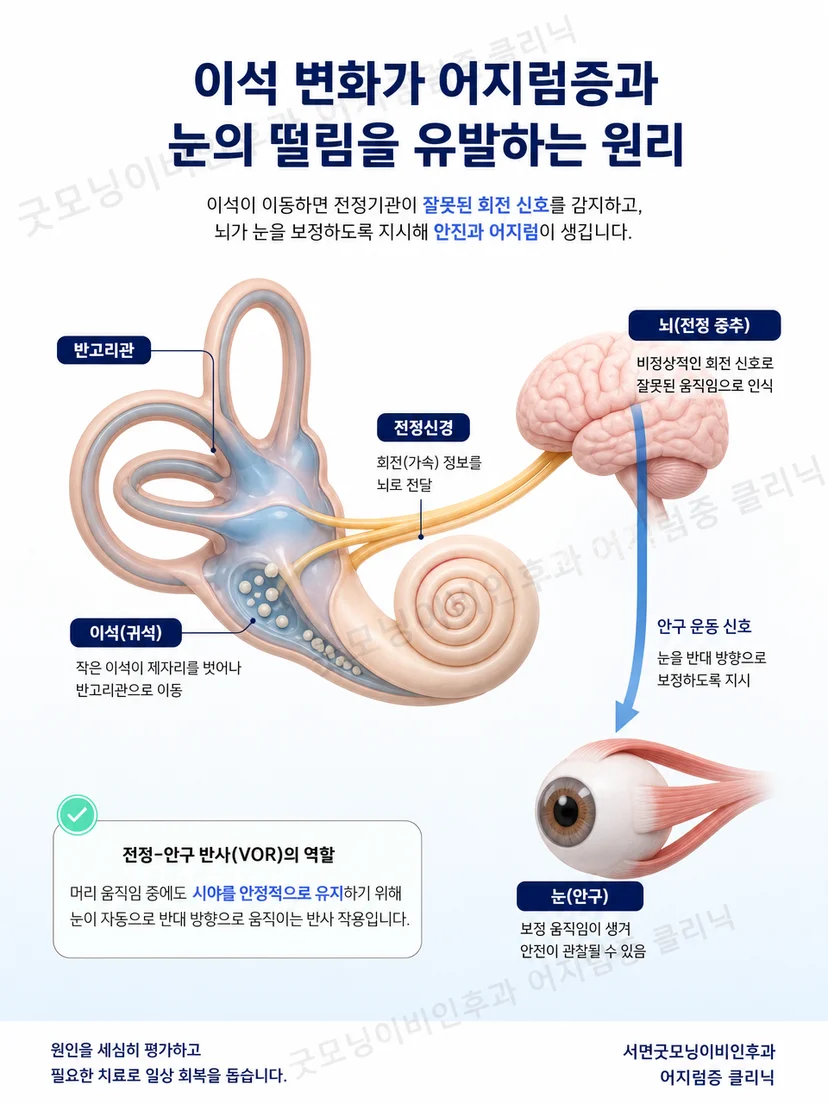 다축 회전으로 자세를 재현하는 TRV Chair 원리 도식