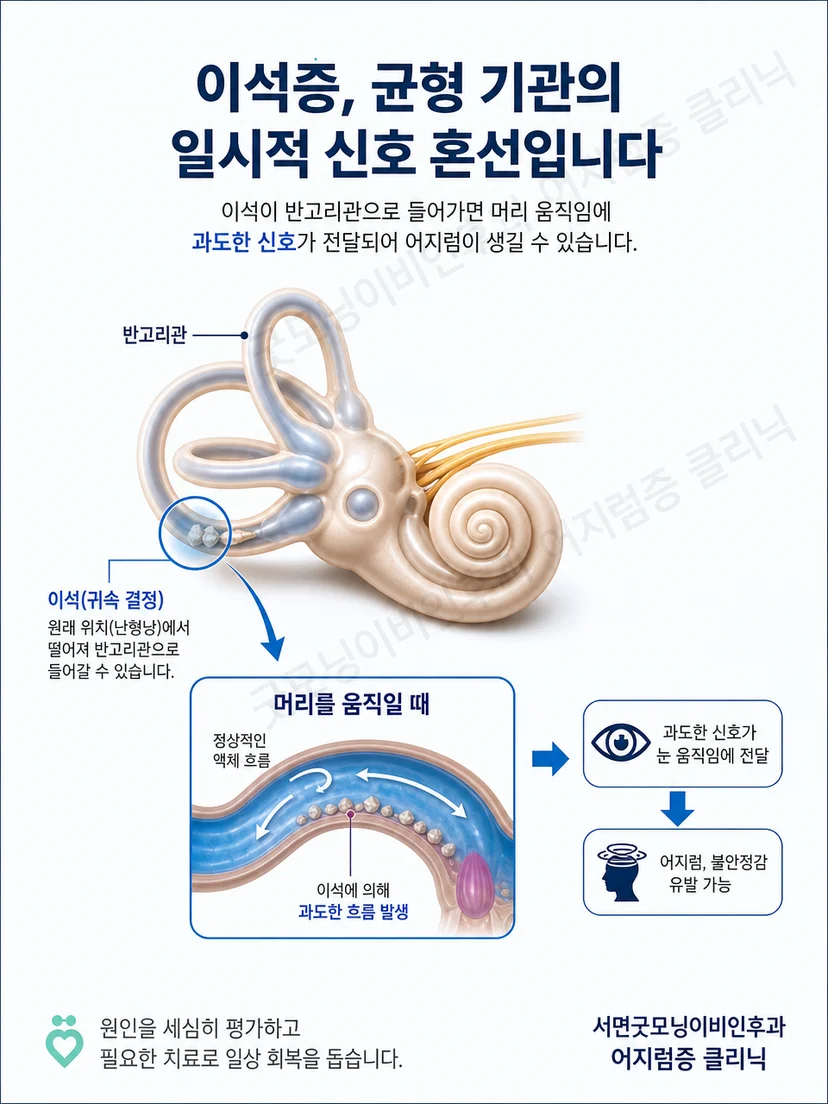 시각과 평형 감각 및 몸의 감각이 균형 유지에 관여하는 원리