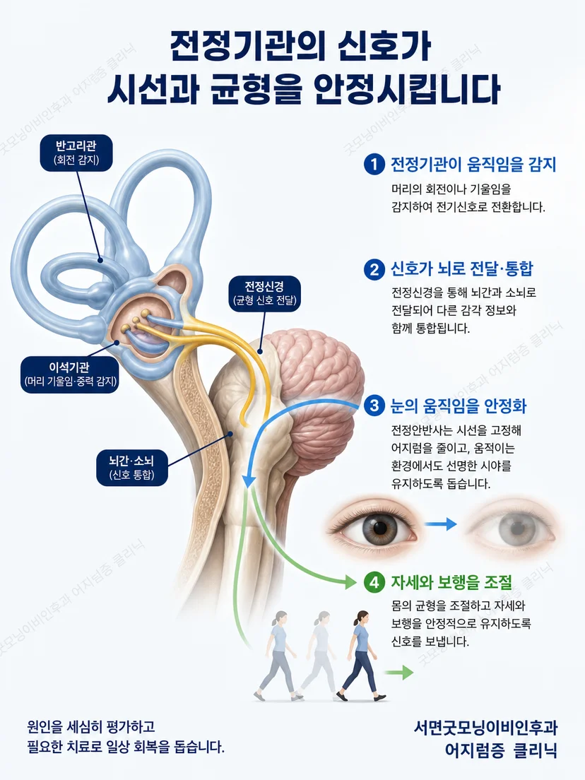 한쪽 전정기능 저하 후 뇌의 전정보상 원리를 설명하는 그림