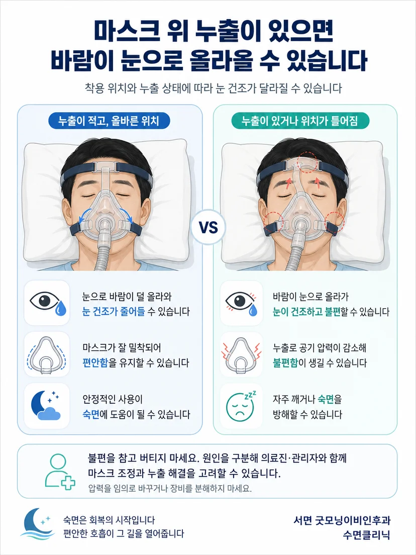 양압기 누출과 결로 및 피부 압박을 구분하는 핵심 사항