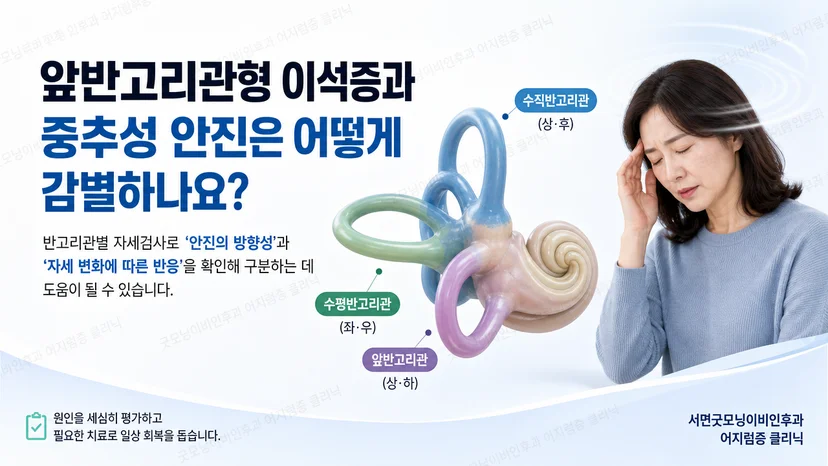 앞반고리관형 이석증과 중추성 안진 감별의 핵심을 설명하는 그림