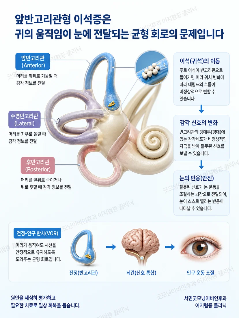 앞 뒤 수평반고리관의 공간 방향을 보여주는 삼차원 내이 도식