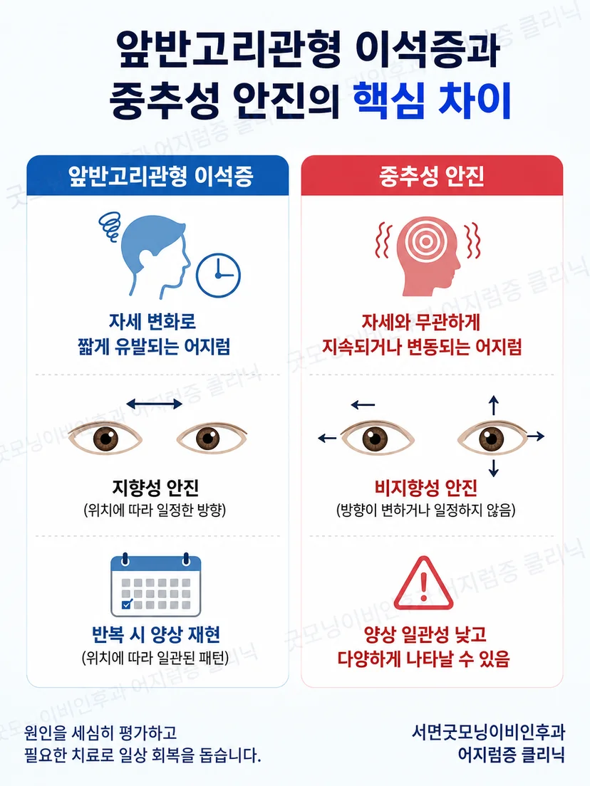 앞반고리관형 안진과 중추성 안진의 관찰 차이를 비교한 그림