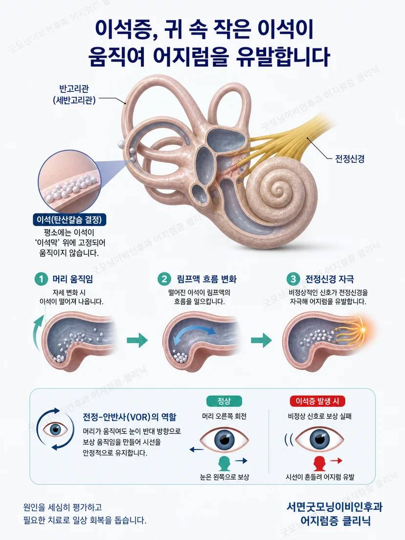 머리 자세와 귀 안 평형기관 자극의 관계를 설명하는 그림