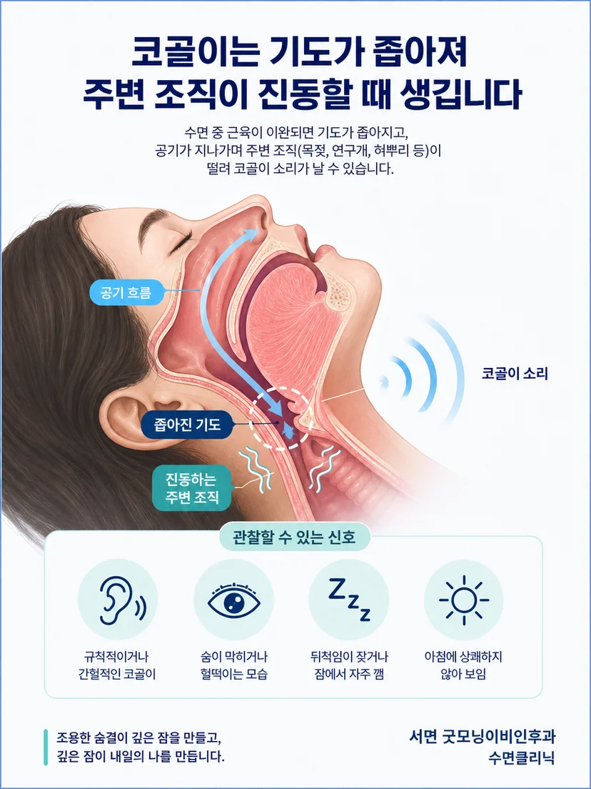 수면 중 공기 흐름과 연조직 진동으로 발생하는 코골이 원리