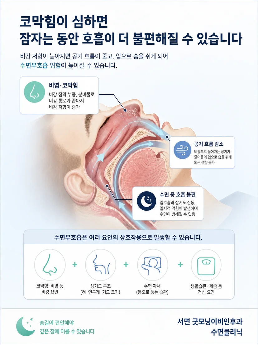 코와 혀 연구개를 포함한 상기도 구조와 공기 흐름 그림