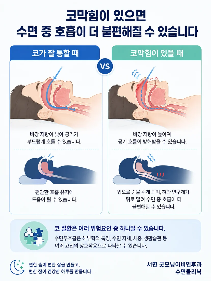 코막힘 위험요인과 수면무호흡 진단을 구분하는 교육 그림