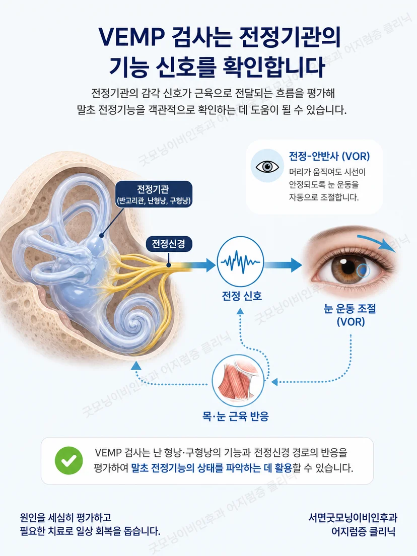 이석기관과 전정신경에서 근육 반응으로 이어지는 VEMP 원리 그림