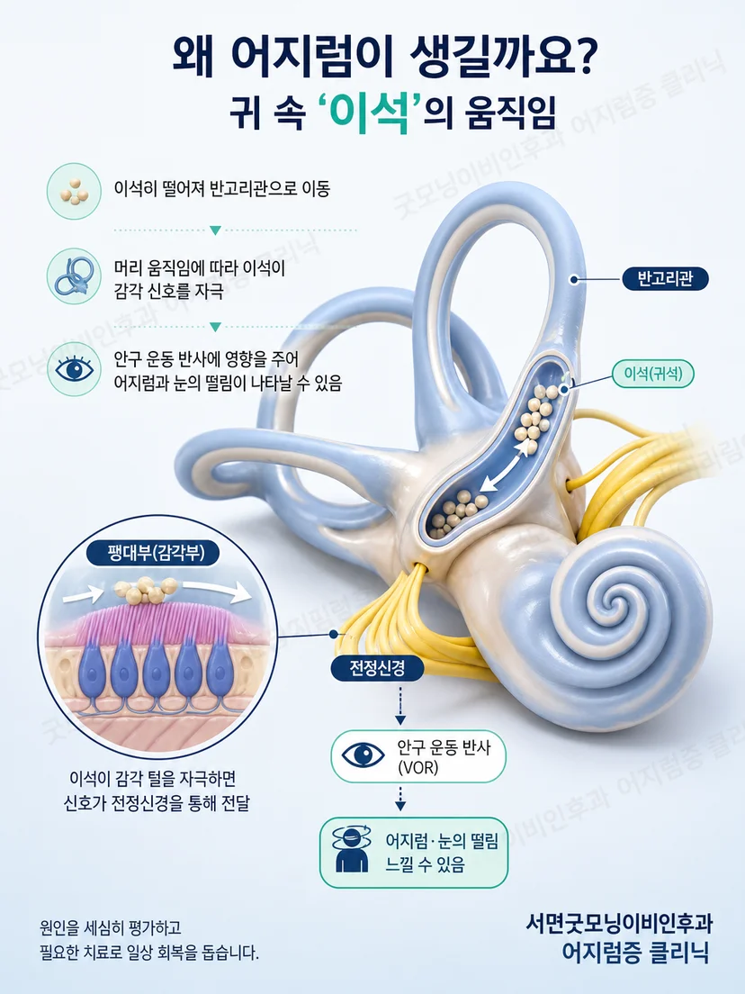 반고리관 위치에 맞추어 체위를 단계적으로 바꾸는 원리