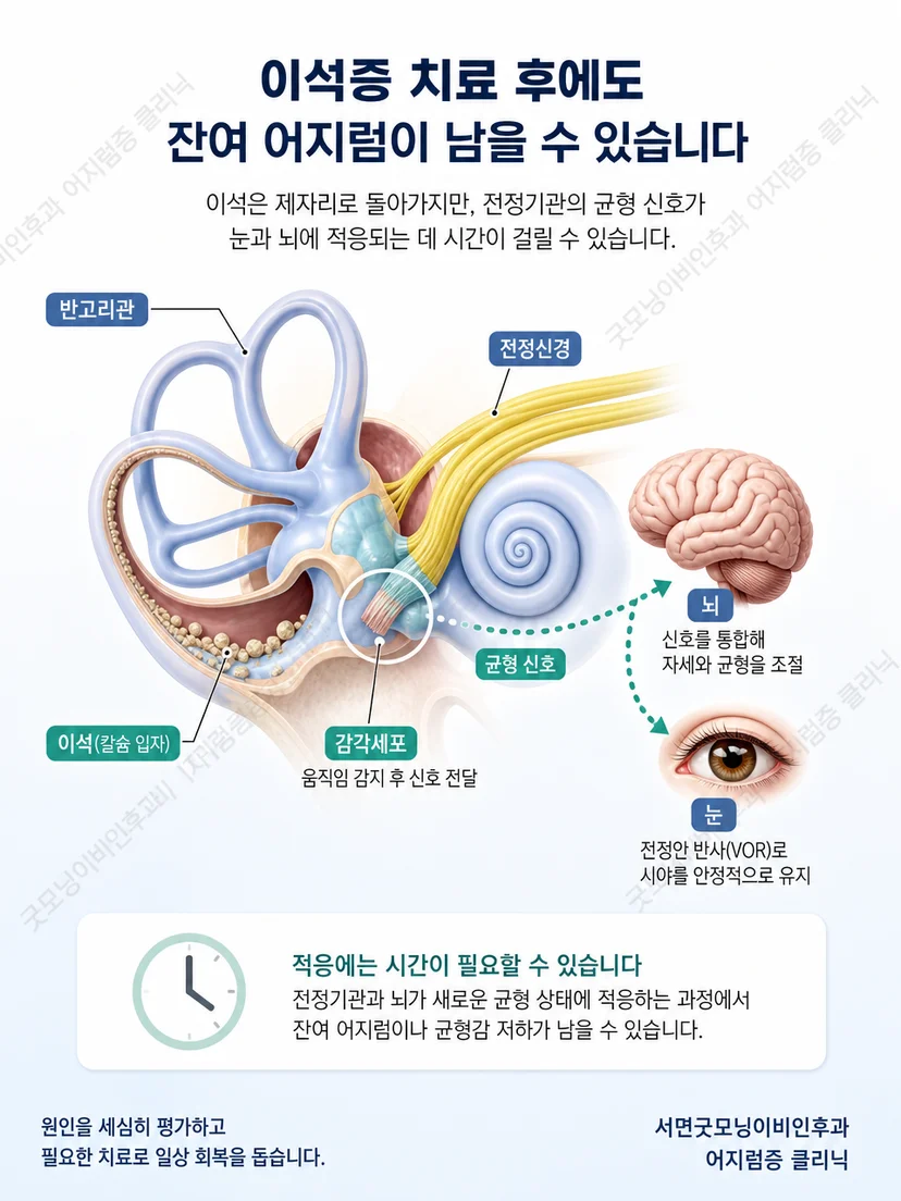 이석증 치료 후 균형 체계가 움직임에 적응하는 원리