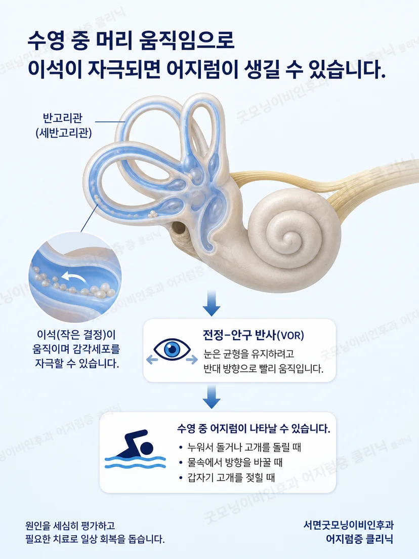 이석의 이동과 머리 위치에 따른 회전감 원리 설명