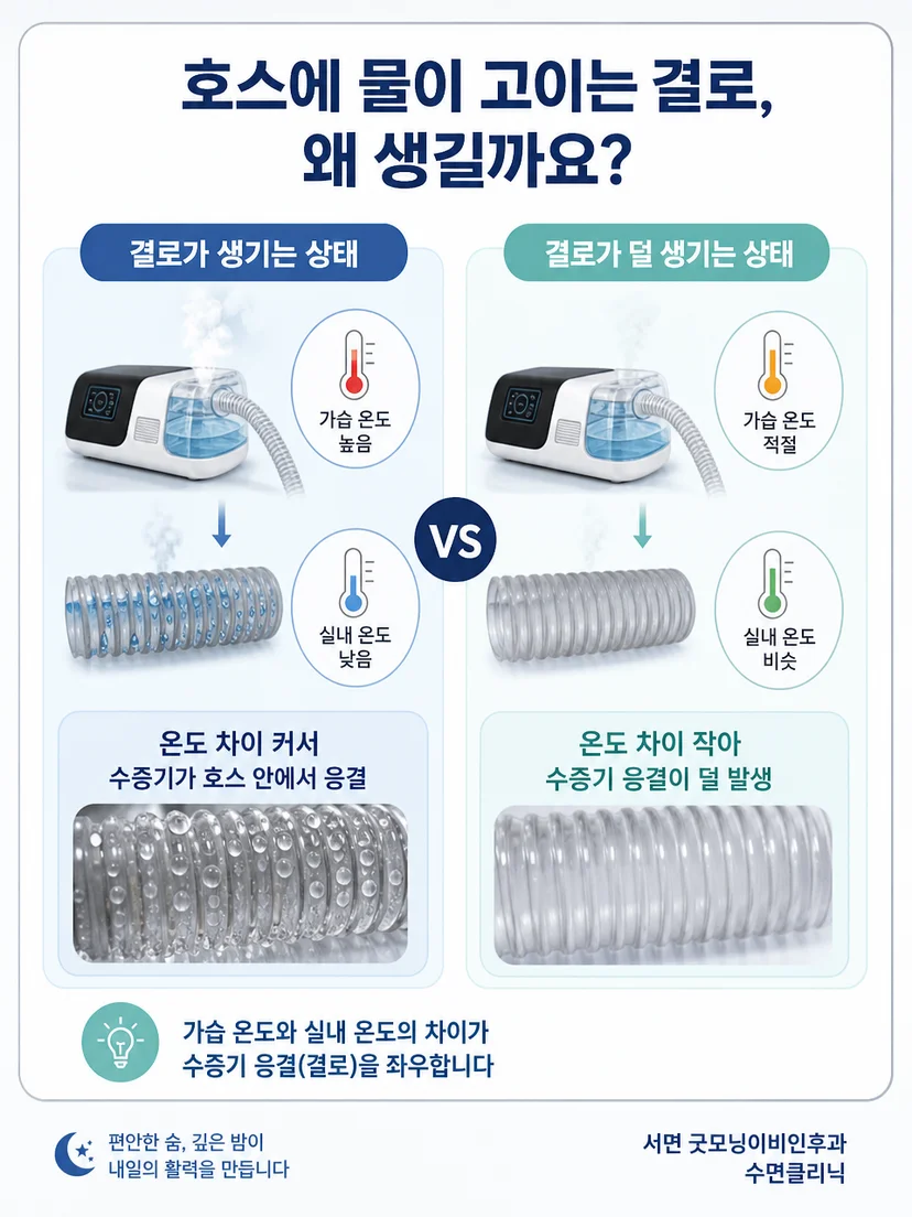 양압기 결로와 마스크 누출 및 피부 압박을 구분하는 장면