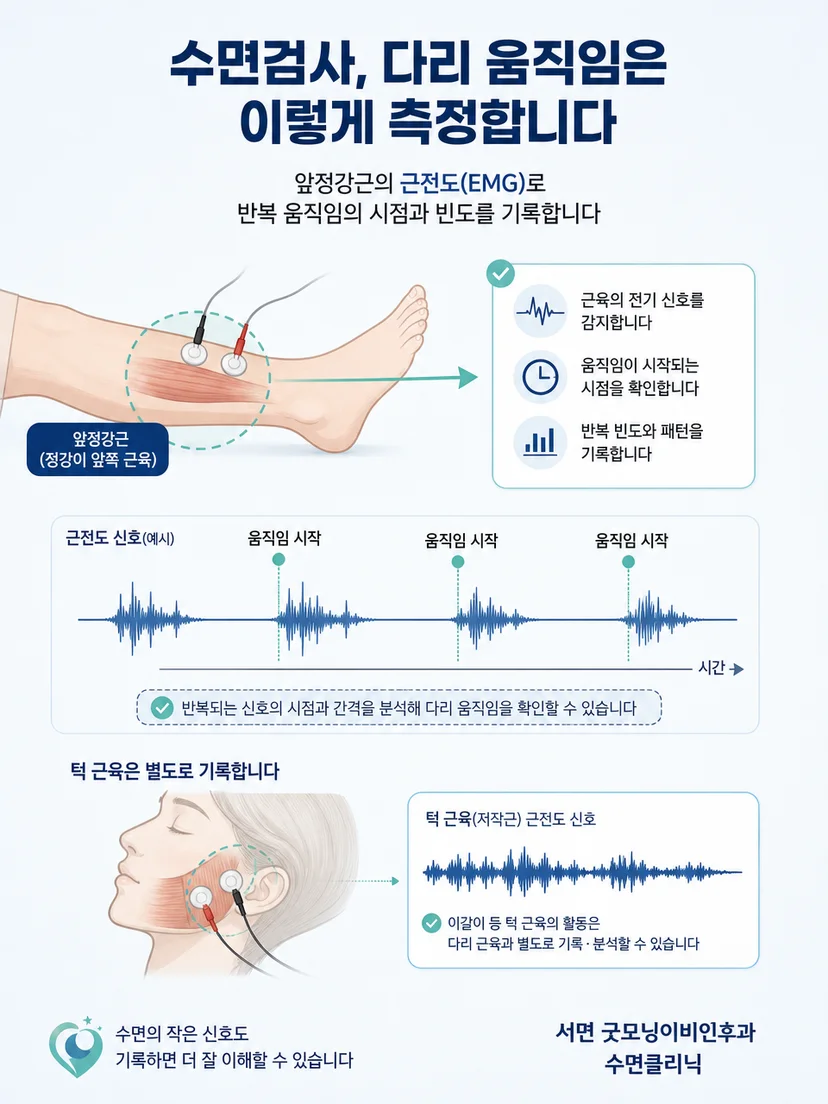 앞정강근의 활성 신호가 근전도 파형으로 기록되는 과정